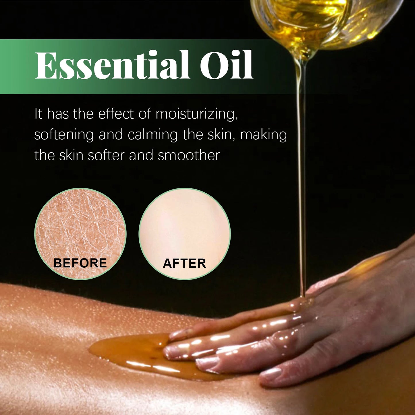 Aceite Esencial De Eucalipto